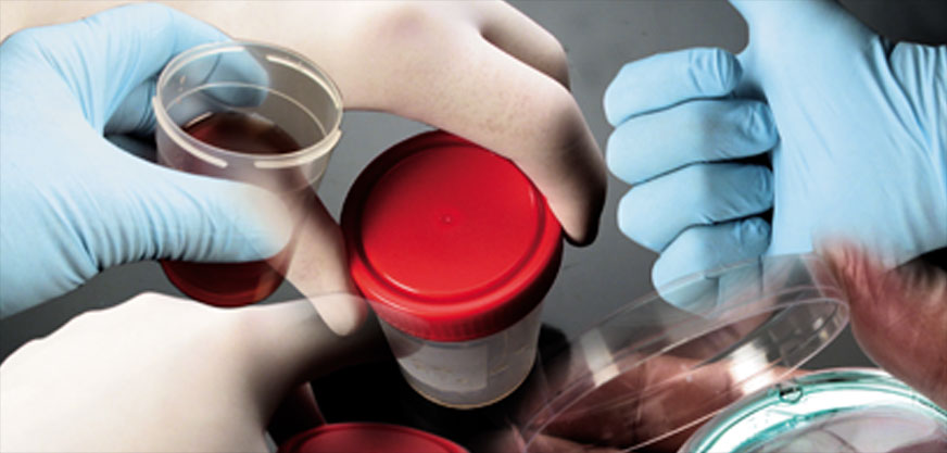 Deltalab en Achema 2015